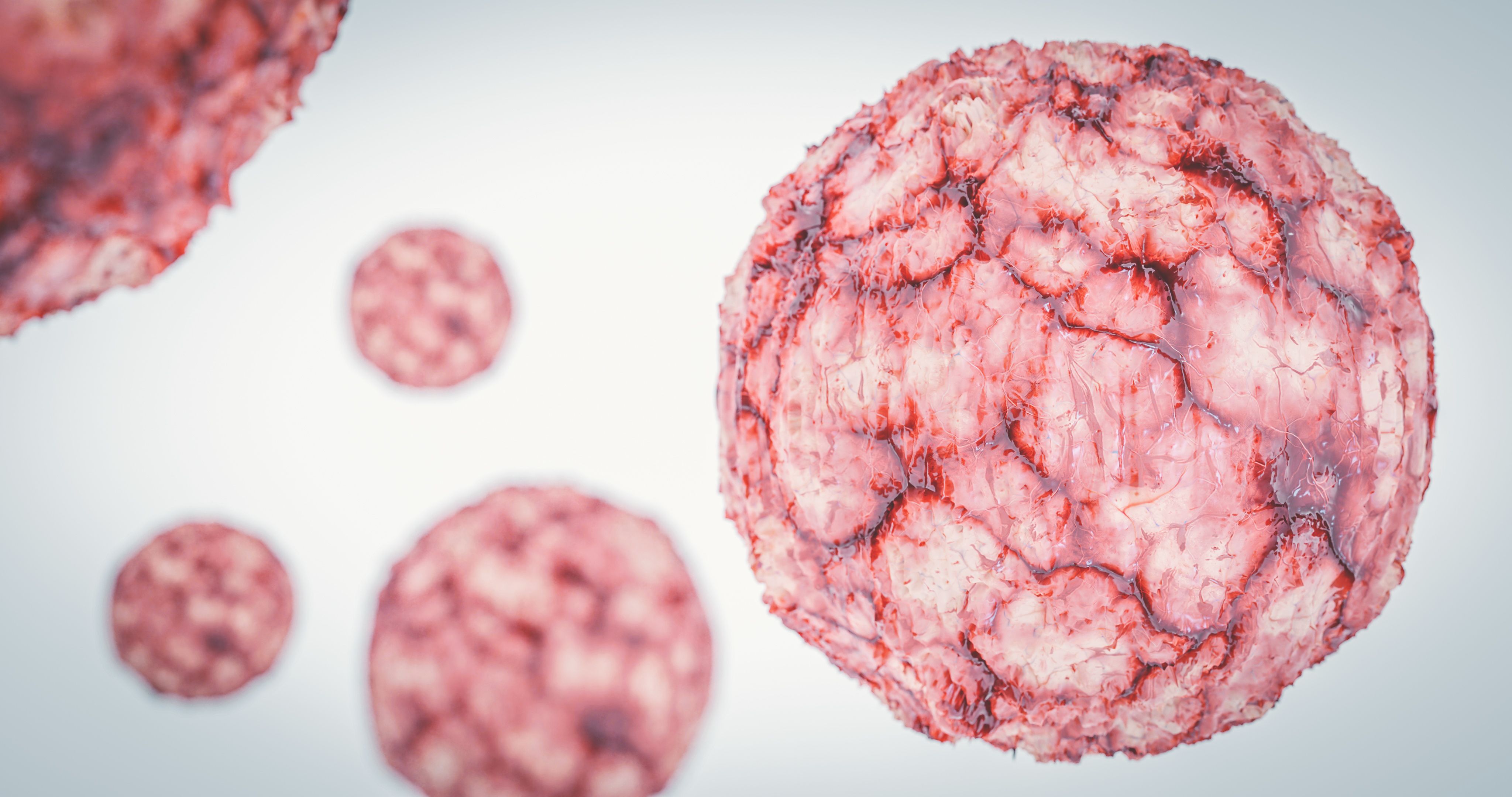 Lymphoma Cancer Cell Hematology | Image Credit: catalin - stock.adobe.com