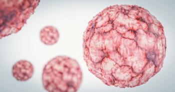 Lymphoma Cancer Cell Hematology | Image Credit: catalin - stock.adobe.com