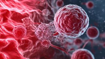 T-cells attacking cancer cells | Image Credit: © HISTOCK - stock.adobe.com