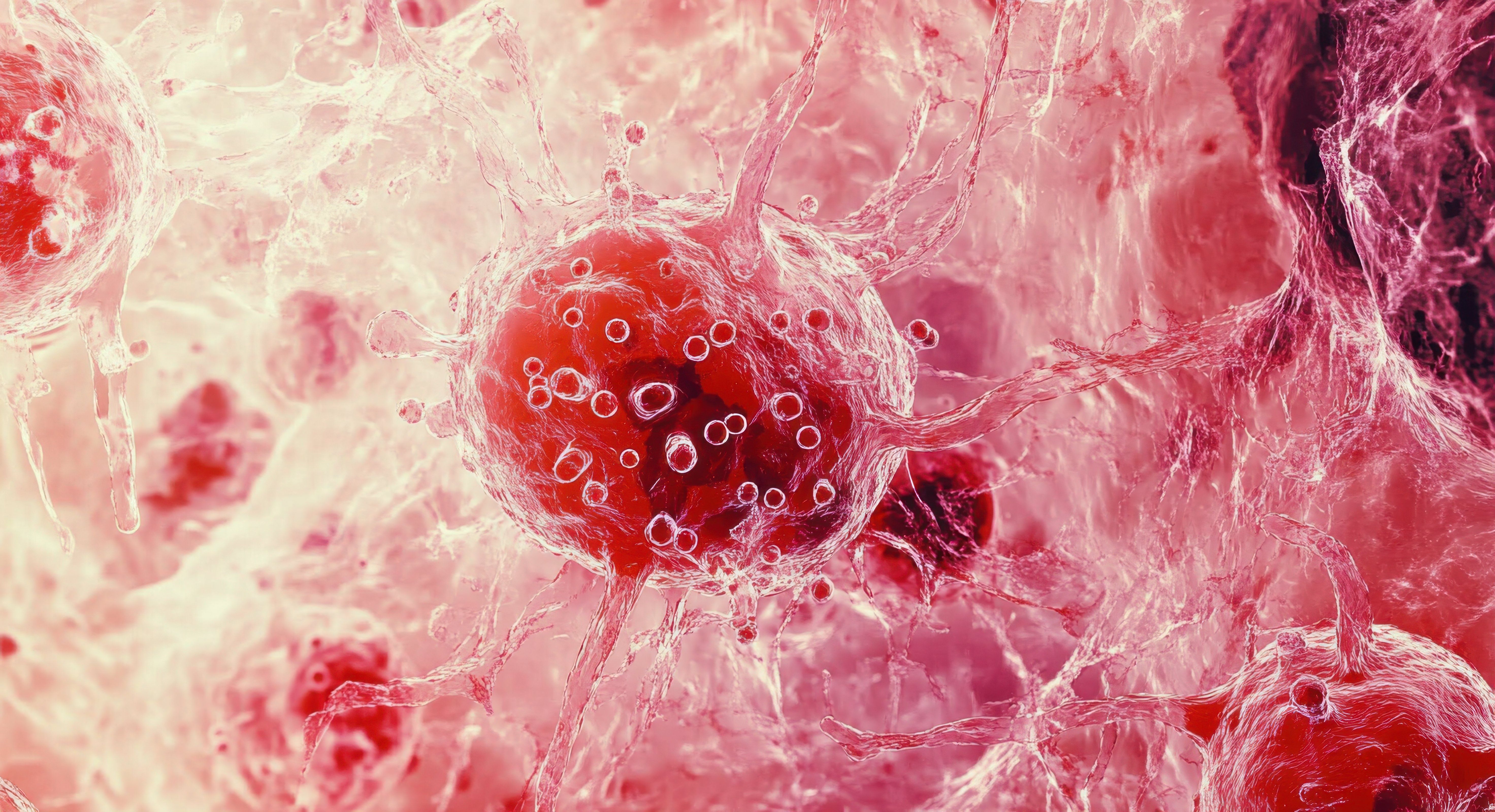 Photomicrograph of Diffuse Large B-Cell Lymphoma | Image Credit: © Maryna - stock.adobe.com
