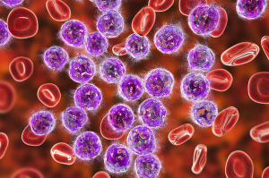 Clinical Insights: Axicabtagene Ciloleucel (Yescarta) 