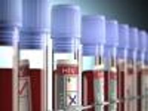 HIV Testing Rates Lag Among Millennials