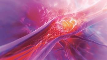 Illustration of myocardial infarction