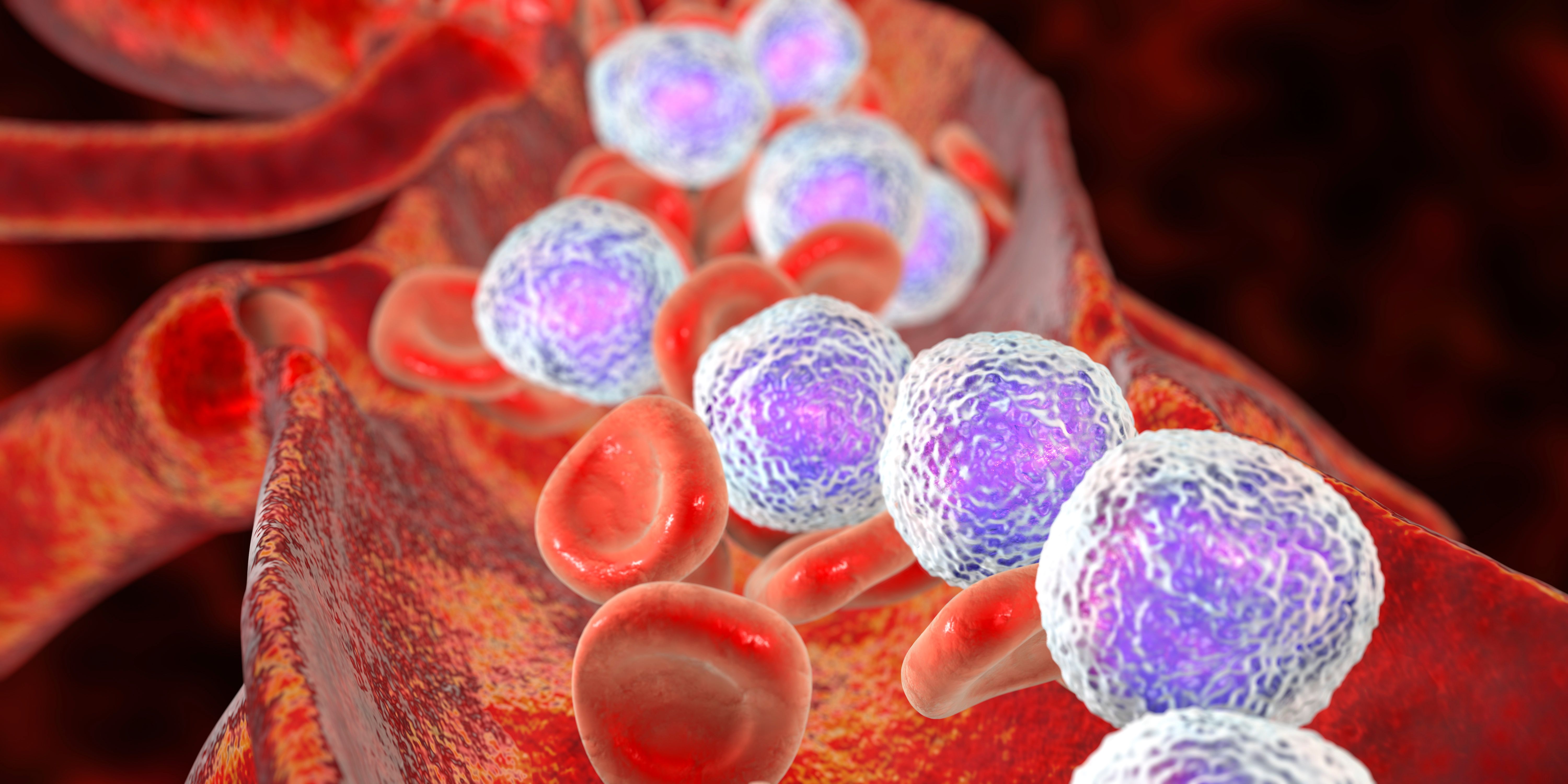 Quizartinib Plus Chemotherapy Improved Os In Patients With Aml Little Quizartinib Plus Chemotherapy Improved Os In Patients With Aml Little