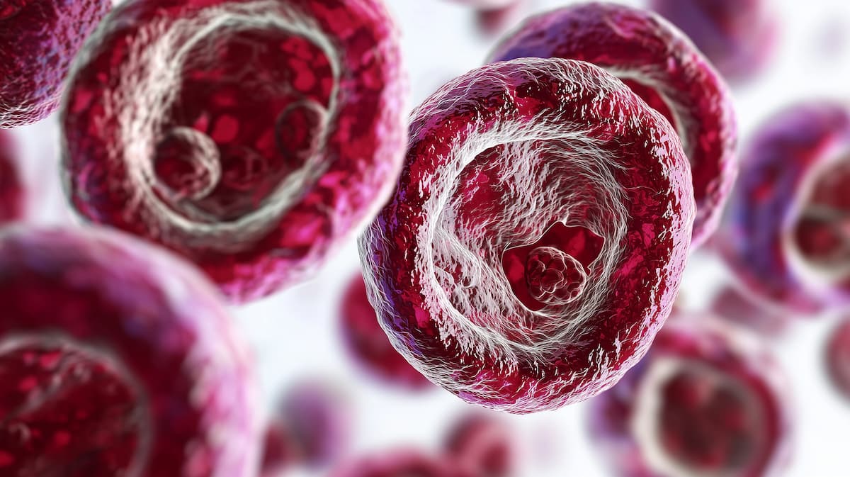 Vector Representation of Acute Myeloid Leukemia Cells