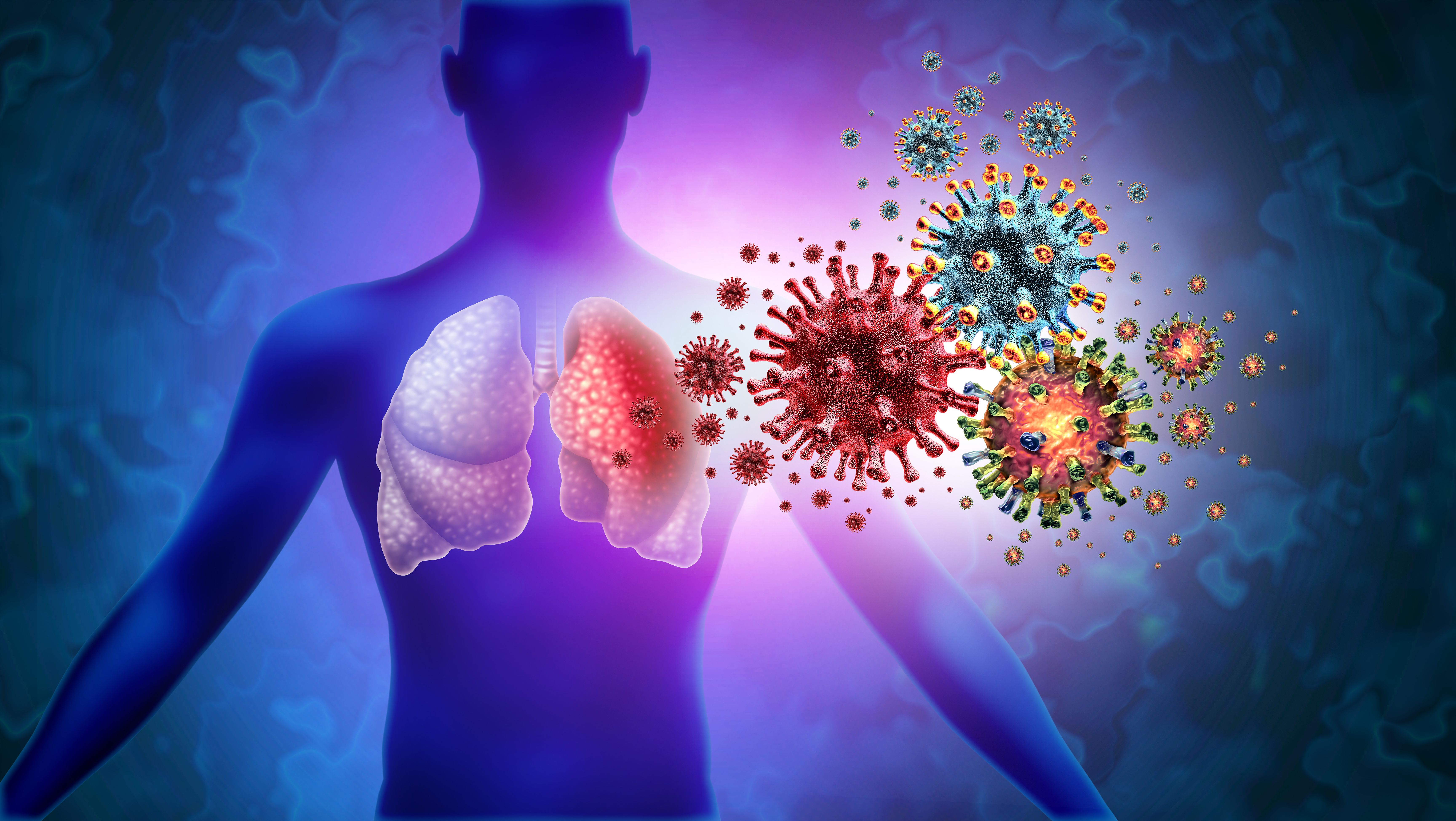 Triple Virus Lung Infection and Tripledemic Human lung infection and respiratory inflammation disease as influenza flu outbreak or pneumonia and pulmonary illness - Image credit: freshidea | stock.adobe.com