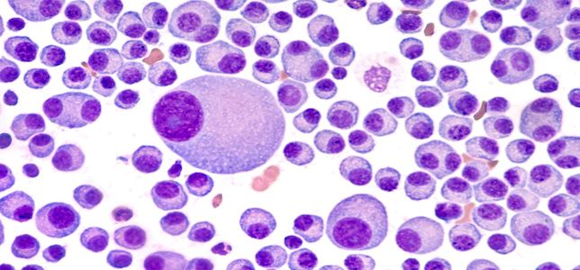Upcoming Trial to Investigate Belantamab Mafodotin in Patients With Relapsed, Refractory Multiple Myeloma