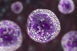 Rate of Treatment-Related Mortality, Most Common Causes in the Treatment of Burkitt Lymphoma
