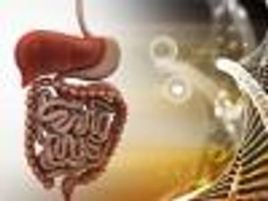 Antifungals, Probiotics Offer Potential Treatment for Crohn's Disease
