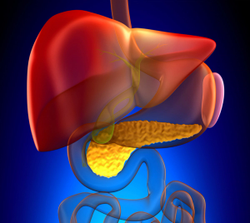 Percutaneous Hepatic Perfusion Procedure May Extend Life for Patients With Inoperable Cholangiocarinomas 