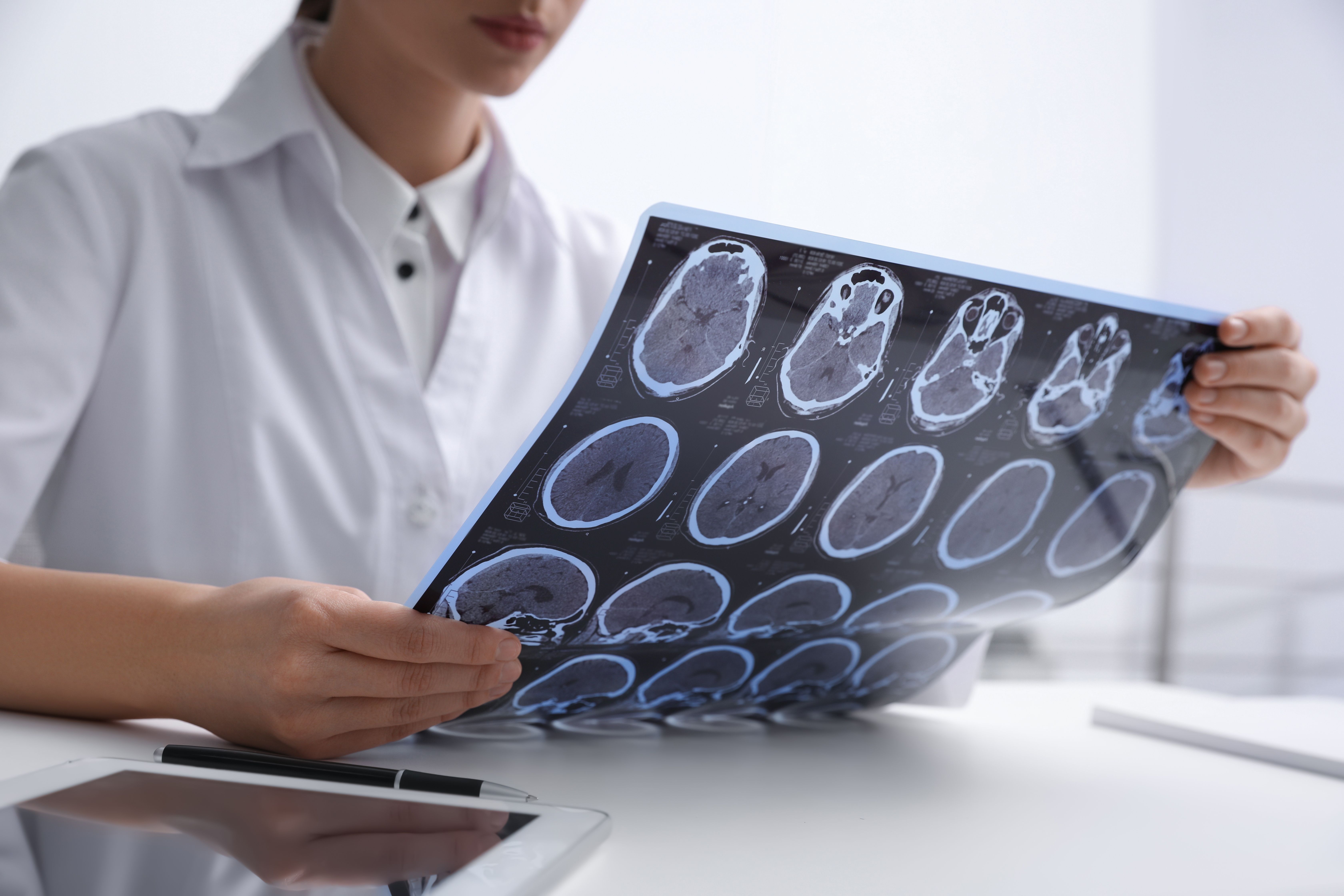 Doctor examining MRI images of patient with multiple sclerosis at table in clinic, closeup | Image Credit: New Africa - stock.adobe.com