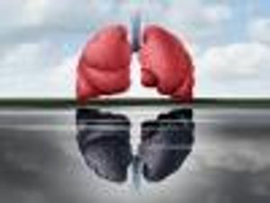Benralizumab for Severe Eosinophilic Asthma