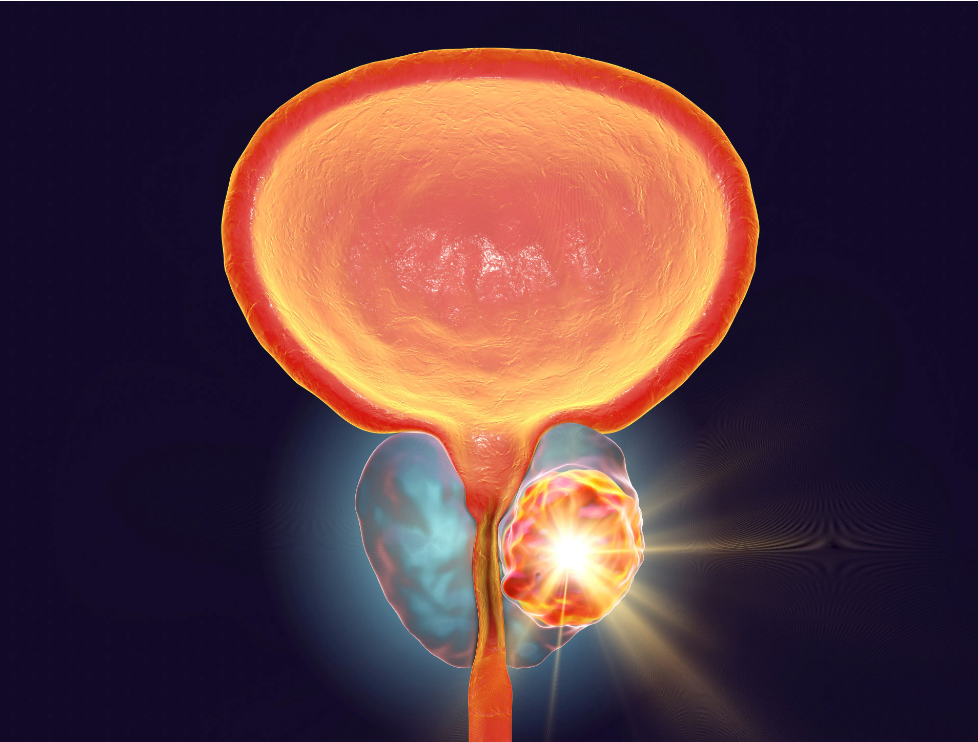 Image credit: DrImage credit: Dr_Microbe - stock.adobe.com_Microbe - stock.adobe.com