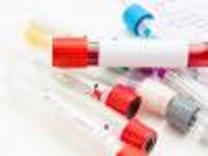 Most Up-to-Date HIV Infections Per Household Estimate in the US