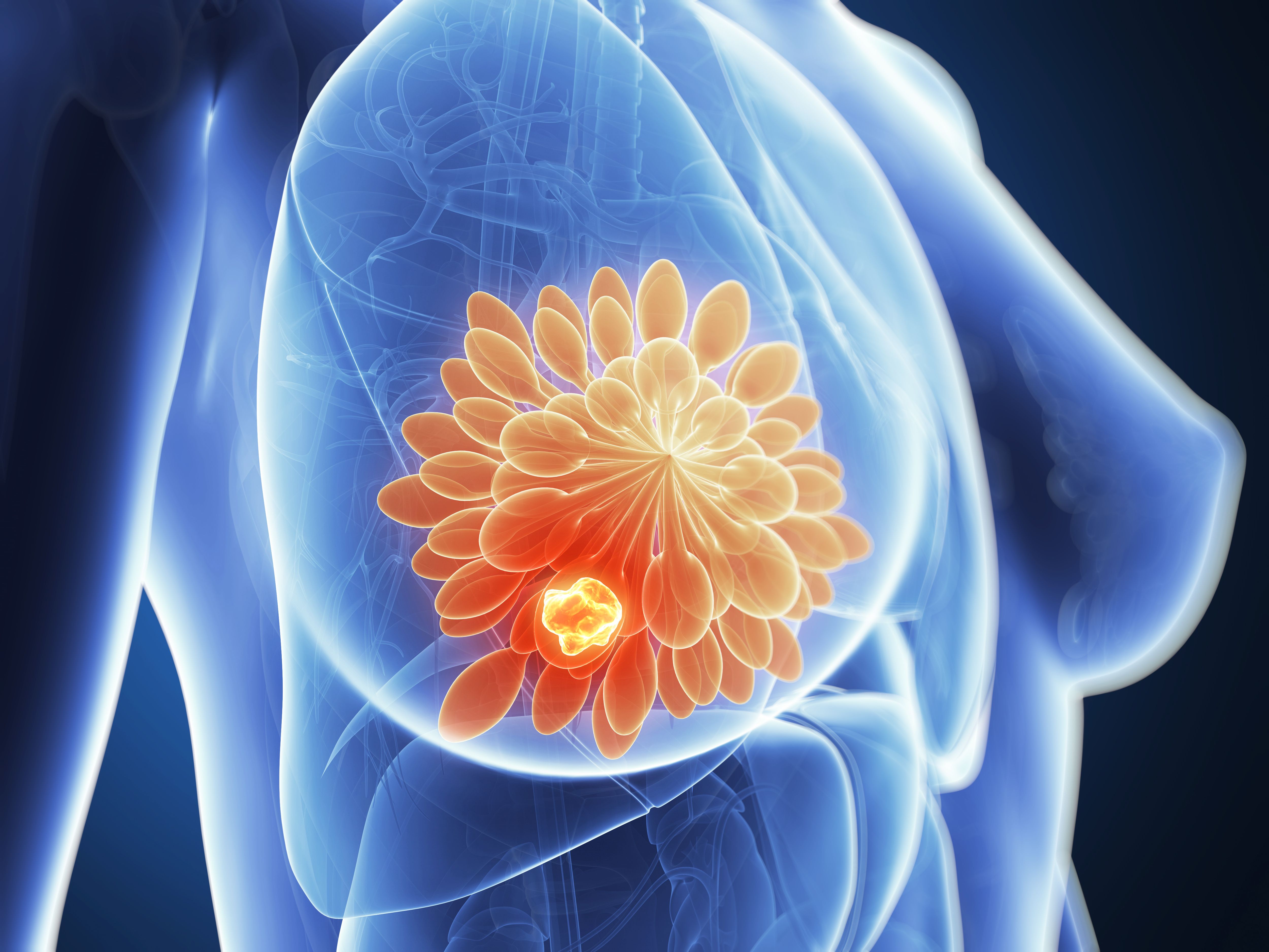 3D x-ray rendering of a breast cancer tumor | Image credit: Sebastian Kaulitzki | stock.adobe.com