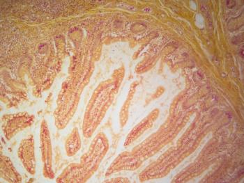 Paneth cells in stomach -- Image credit: DrWD40 | stock.adobe.com