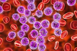 Destruction of lymphoblasts. Conceptual 3D illustration of treatment of acute lymphoblastic leukemia | Image Credit: Dr_Microbe | stock.adobe.com