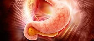 Counsel Patients With GERD About Certain Foods 