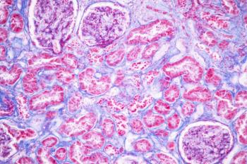 Microscopic view of kidney