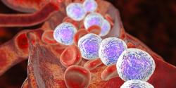 Investigational BTK Inhibitor Shows Promise in Chronic, Small Lymphocytic Leukemia