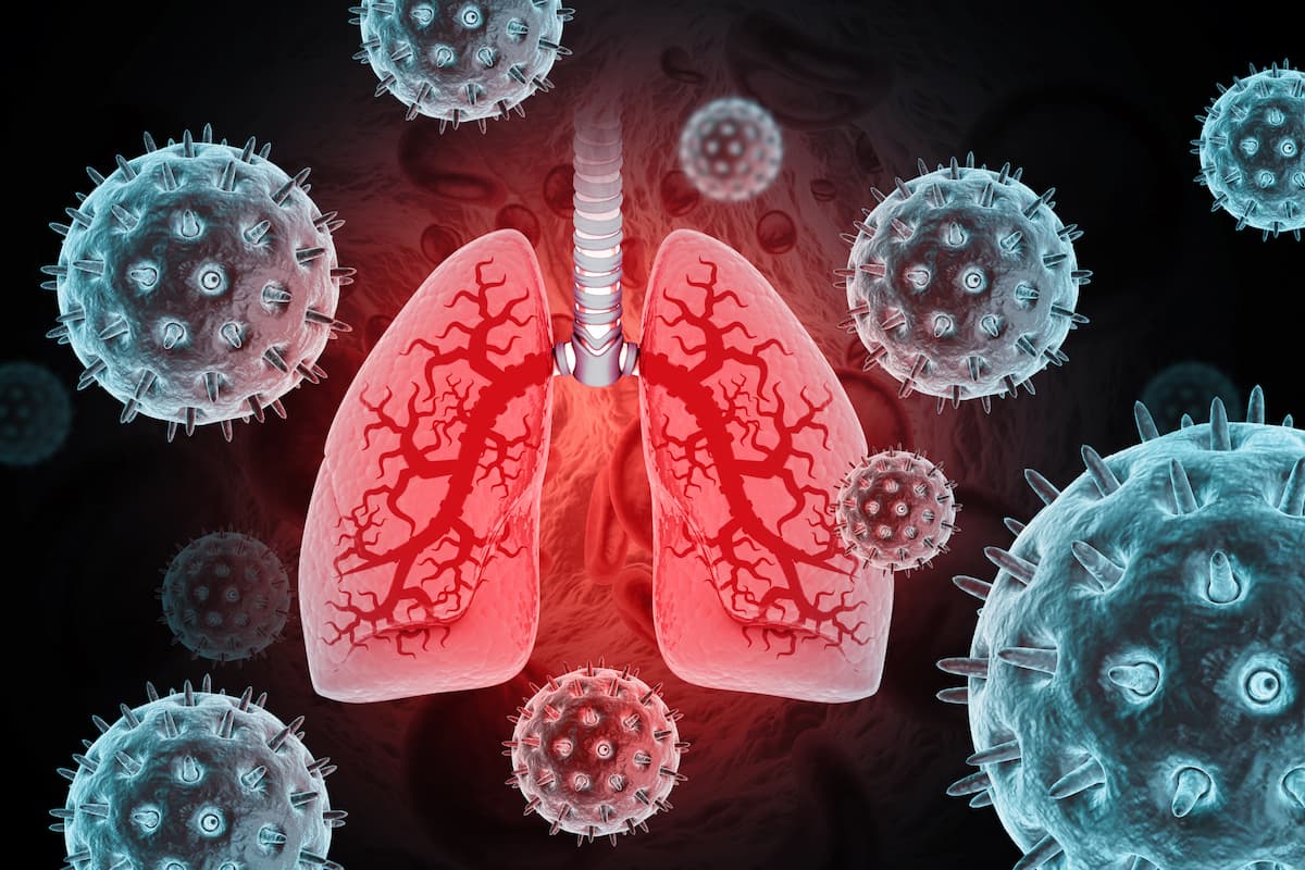 Viral respiratory infection (VRI). Epidemic and pandemic viral infection. 3d illustration