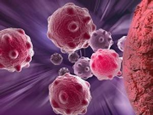 Novel Pen-Like Device Distinguishes Between Tumor, Healthy Tissue 