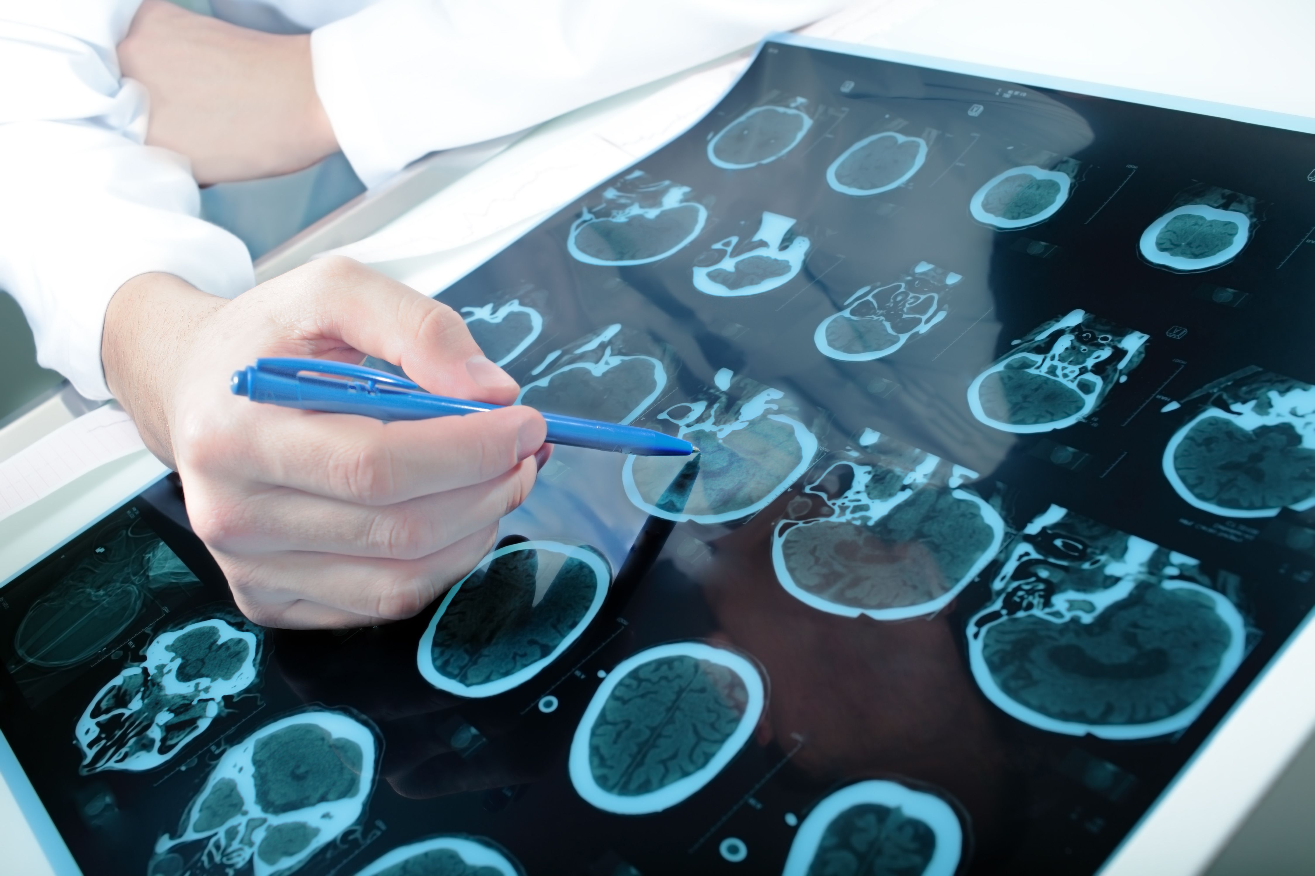 Health care professional looking at scans of brain -- Image credit: sudok1 | stock.adobe.com