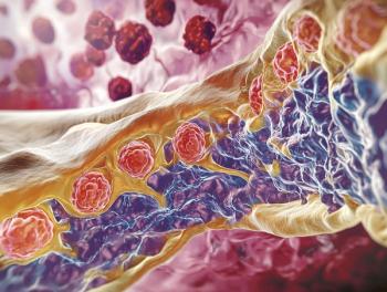 Abnormal myeloma cell growth in bone marrow | Image Credit: © Khella - stock.adobe.com