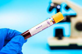 Immune marker Assesses globulin levels, elevated in cancers