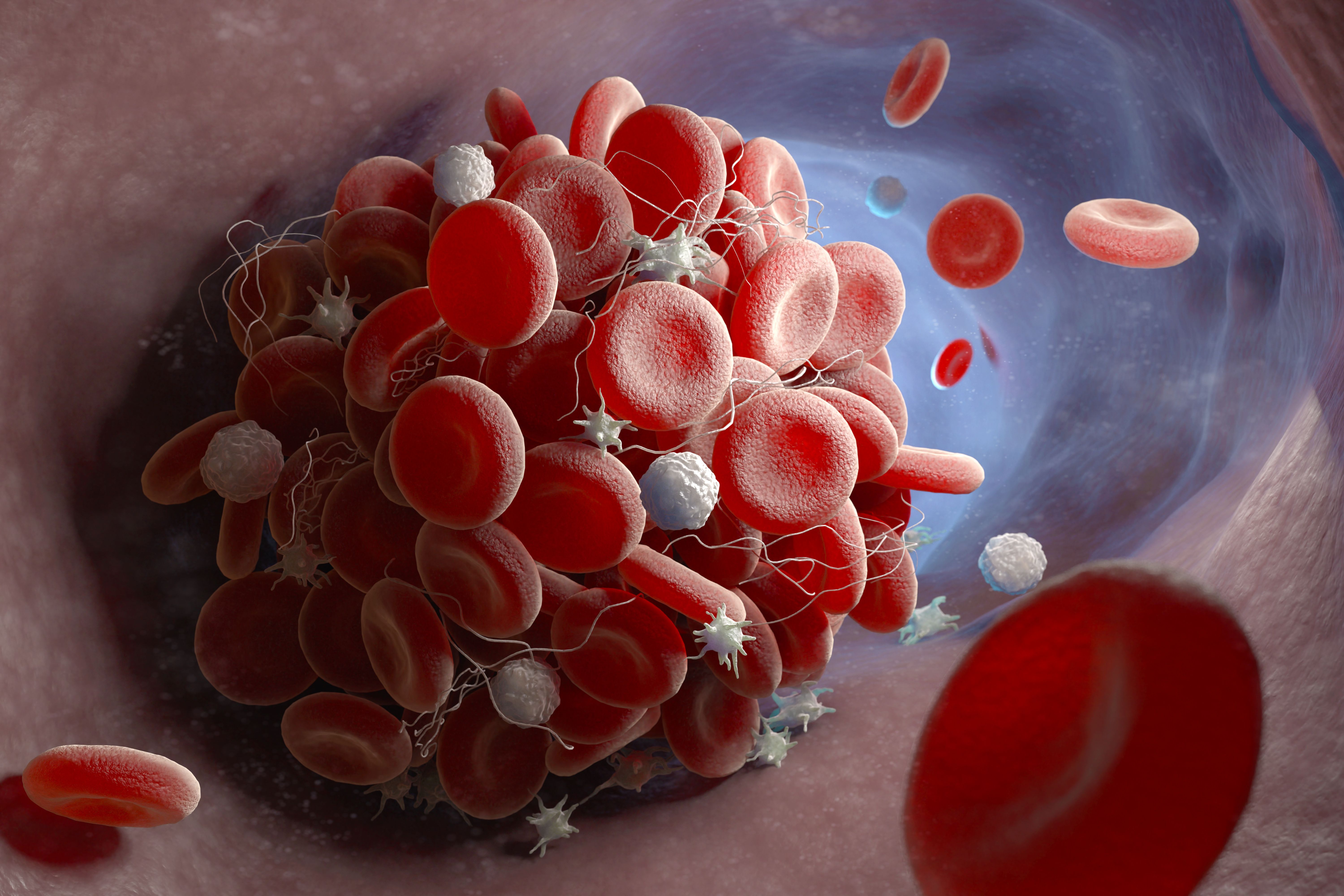 Formation of a blood clot - Image credit: Tatiana Shepeleva | stock.adobe.com