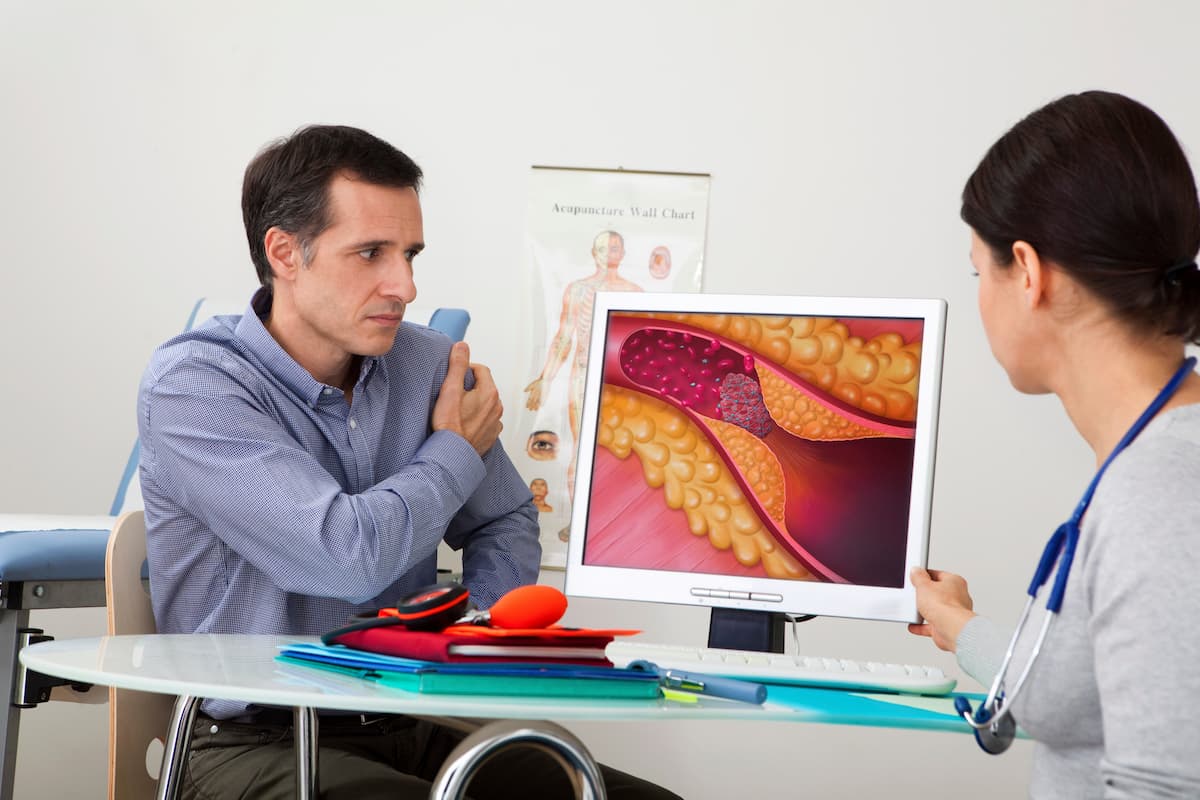 Models On screen, drawing representing an artery obstructed by a thrombus caused by a plaque of atheroma