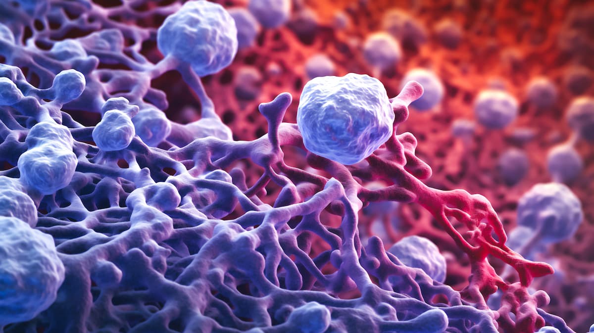 a microscope view of bone marrow showing the presence of abundant mast cells Generative AI