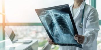 Doctor diagnosing patient’s health on asthma, lung disease, COVID-19 or bone cancer illness with radiological chest x-ray film for medical healthcare hospital service - Image credit: Chinnapong | stock.adobe.com