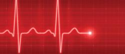 New Data Show Farxiga Lowers Risk of Cardiovascular Death in Patients With Heart Failure