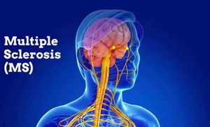 Ozanimod: Treatment for Relapsing Forms of Multiple Sclerosis
