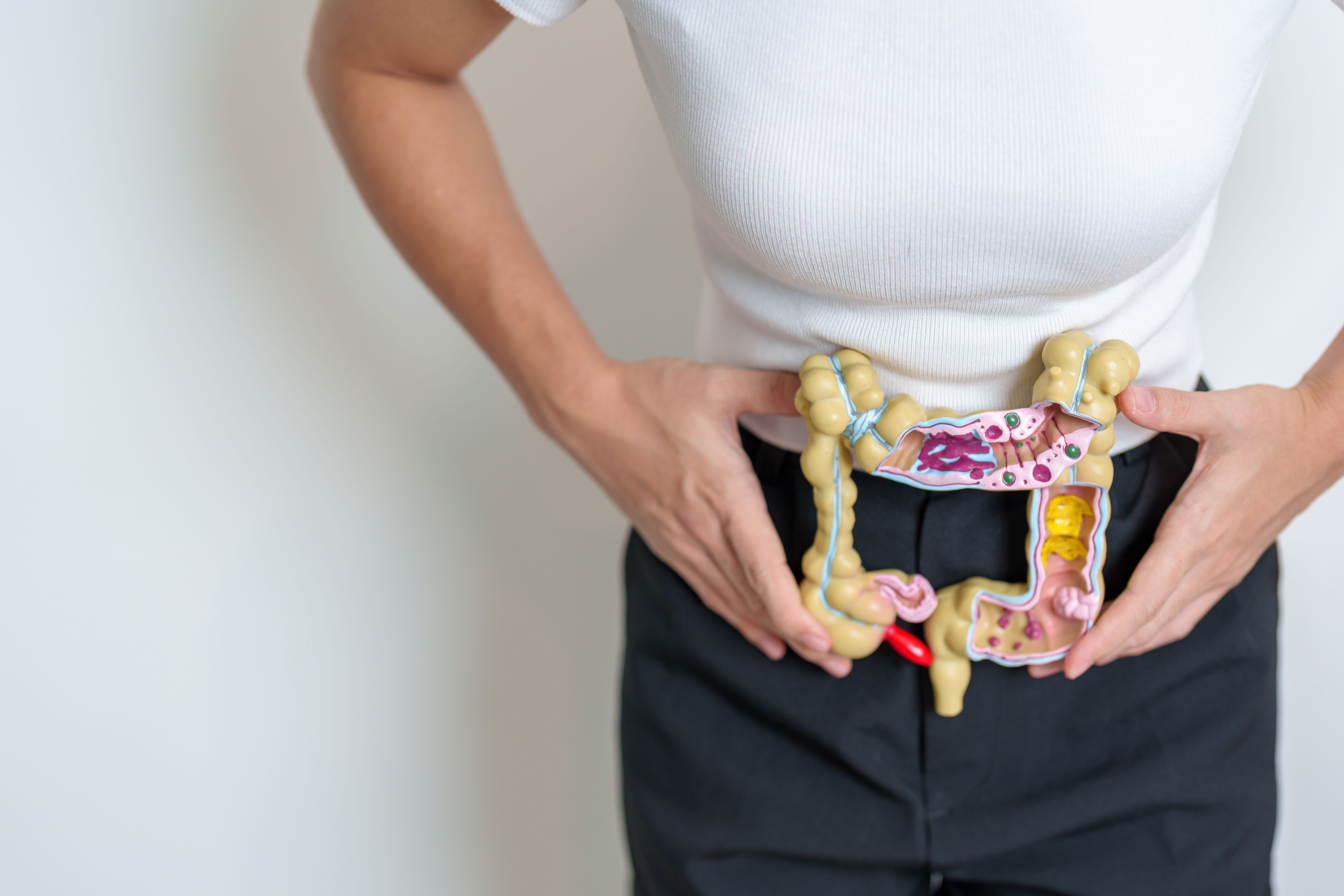 Woman holding a model of the colon