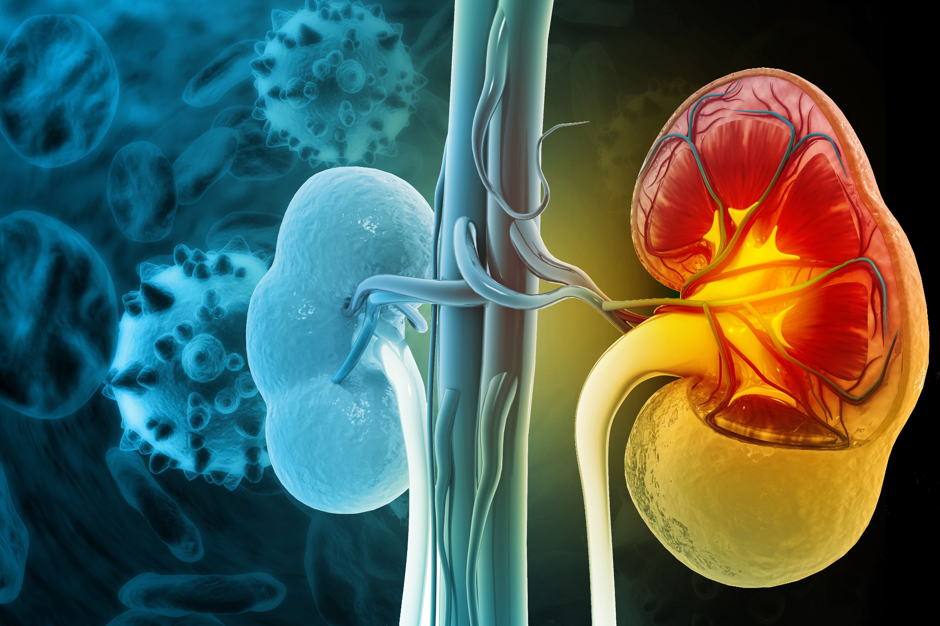 Image depicting kidney affected by CKD -- Image credit: Crystal light | stock.adobe.com