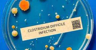 Elevating Antimicrobial Stewardship: Insights From Pharmacist-Led Initiatives Combatting Health Care–Associated C diff