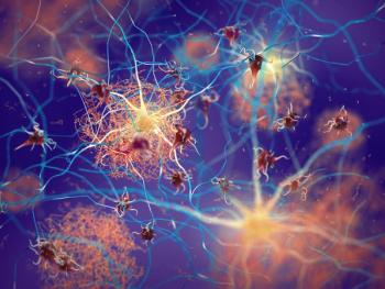 Tau pathology in patient with Alzheimer disease -- Image credit: nobeastsofierce | stock.adobe.com