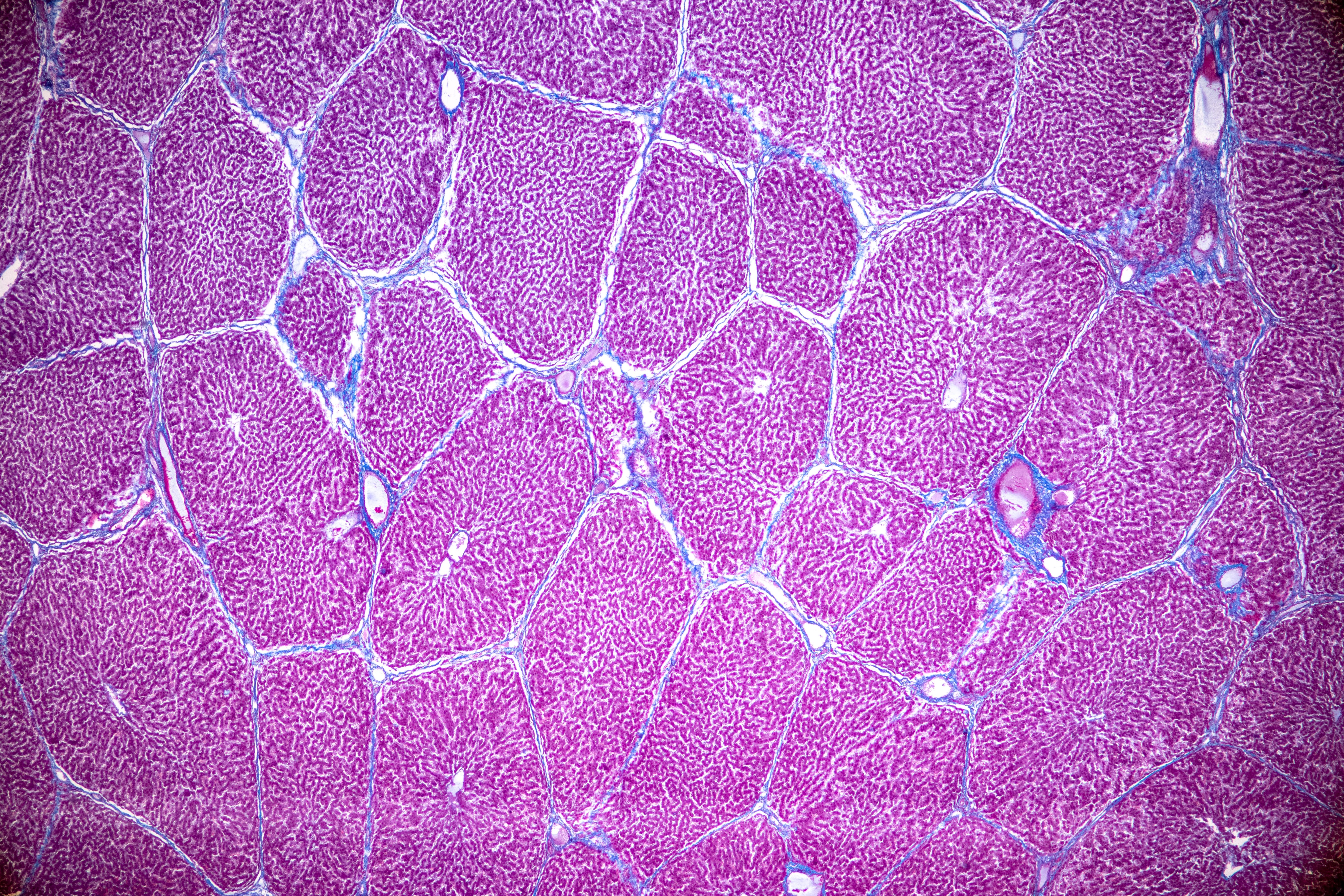 Клетки печени человека под микроскопом