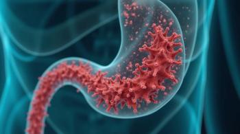 Biliary tract cancer (BTC) -- Image credit: Arugula Pica | stock.adobe.com
