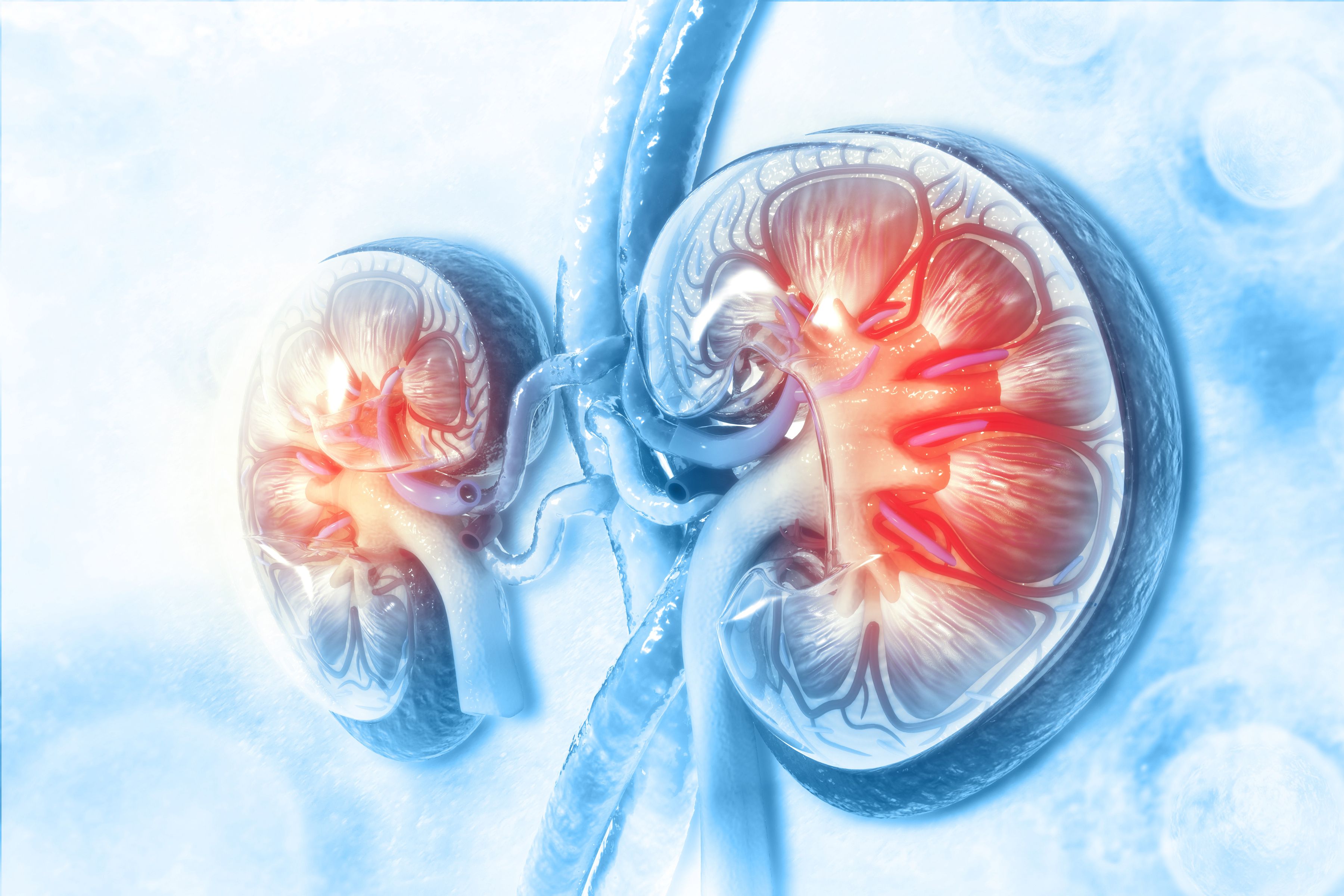 X-ray image of kidneys with CKD -- Image credit: Crystal light | stock.adobe.com