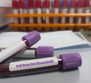 Blood test for graft-vs-host-disease (GVHD) -- Image credit: MdBabul | stock.adobe.com