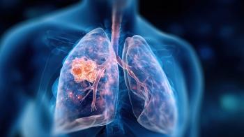 Could Divarasib Challenge Existing KRAS G12C Inhibitors in Lung Cancer?