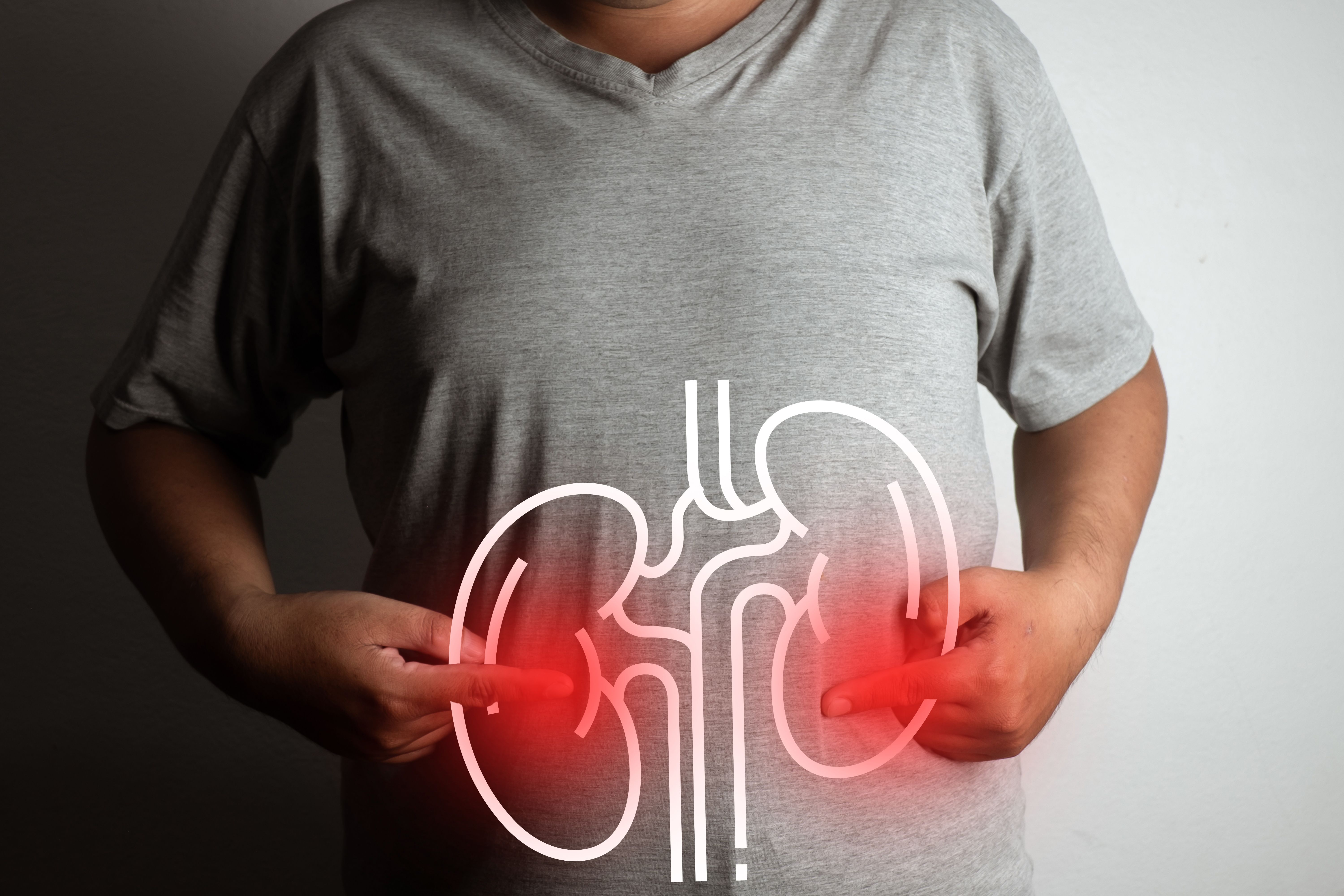 Study: Early Nephrology Consultation Triggered by AI Fails to Prevent Acute Kidney Injury