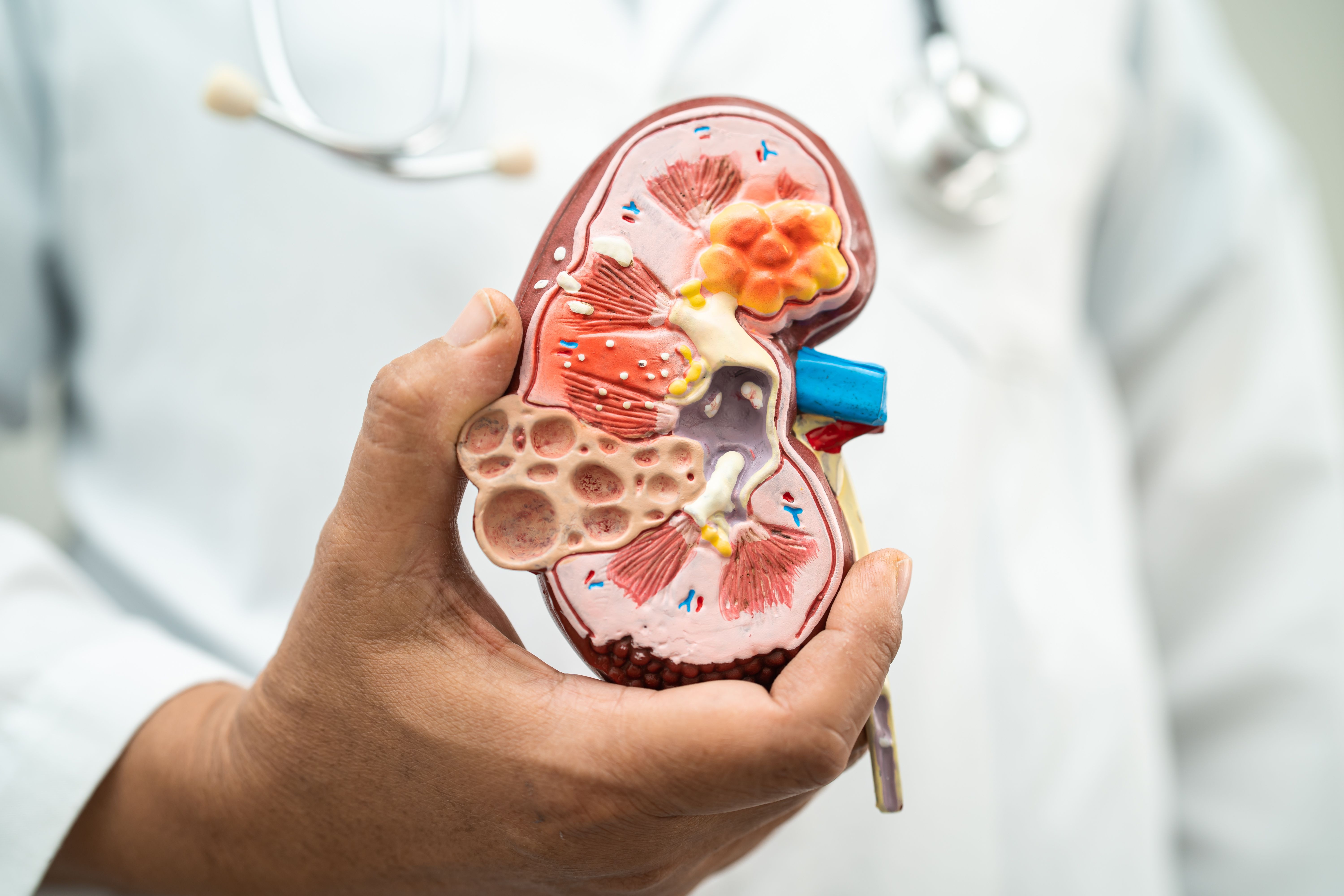 Precision Medicine, Biomarkers, Advancements in Chronic Kidney Disease Treatment