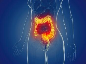Medically accurate illustration of a womans large intestine | Image Credit: Sebastian Kaulitzki - stock.adobe.com