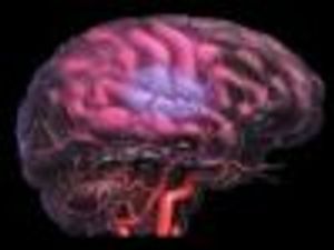 Riluzole Shows No Efficacy as a Neuroprotective Agent in Patients with Early-Stage Relapsing Remitting Multiple Sclerosis