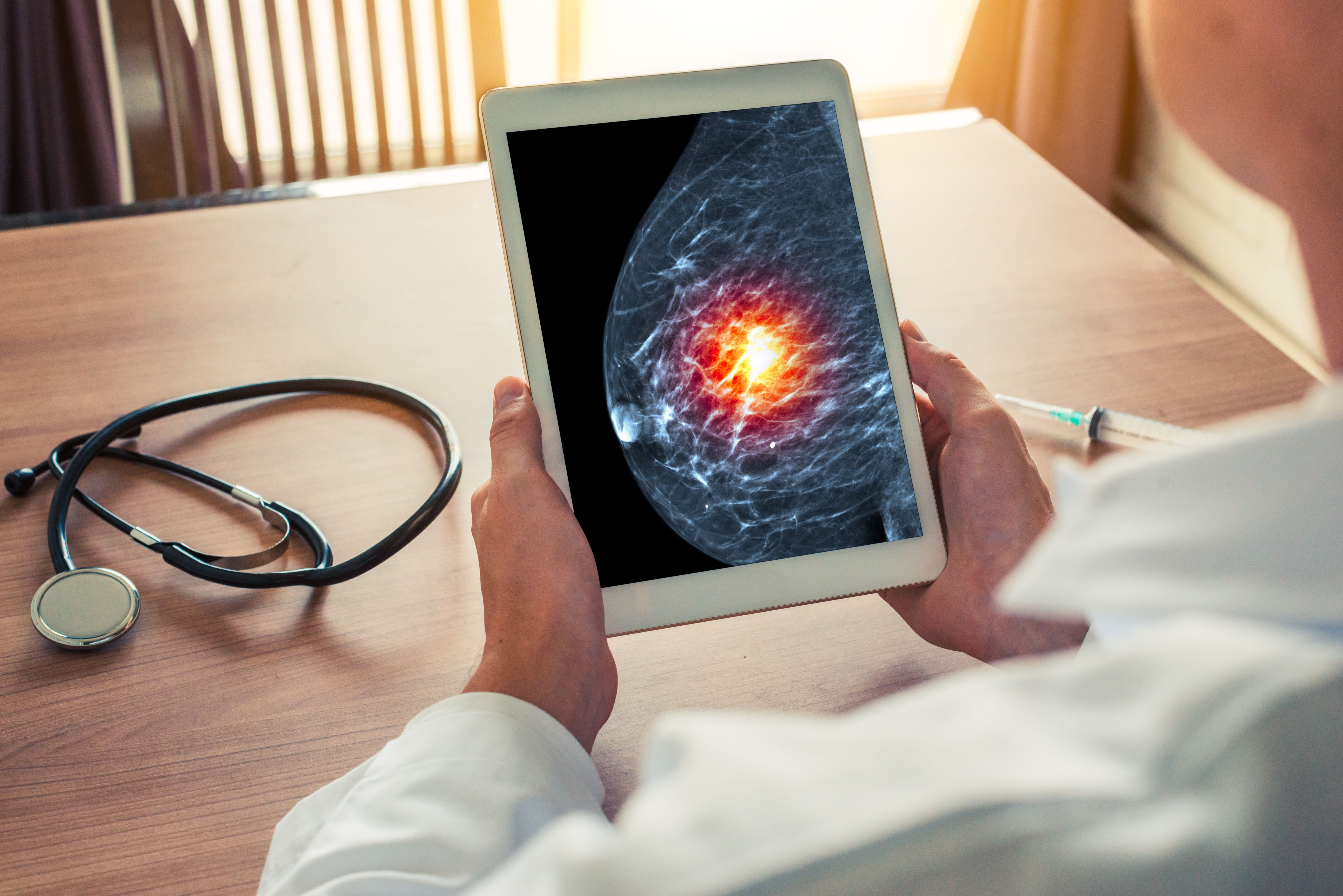 Physician looking at a mammogram