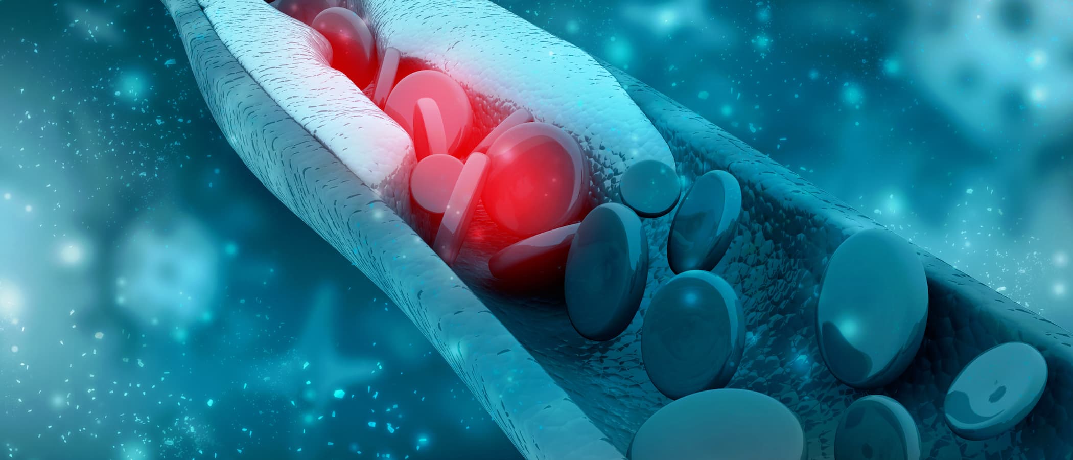 3d rendering blood cells with plaque buildup of cholesterol symbol of vascular illness